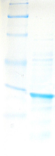 HGPRT Gel