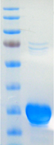 dsk gel photo